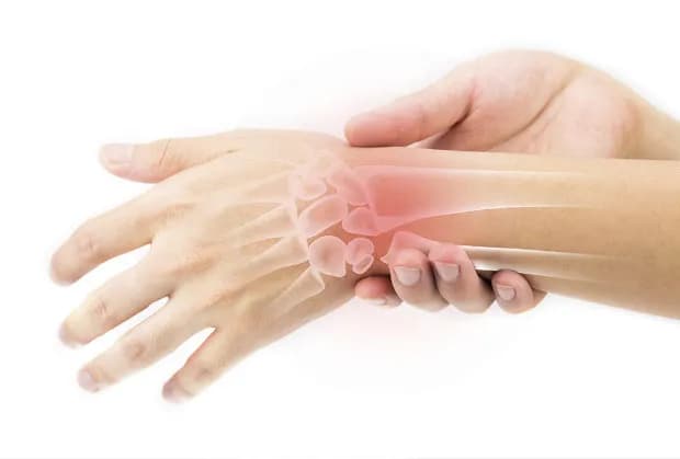 Jak długo trwa rehabilitacja po złamaniu nadgarstka? Czas i etapy powrotu do zdrowia