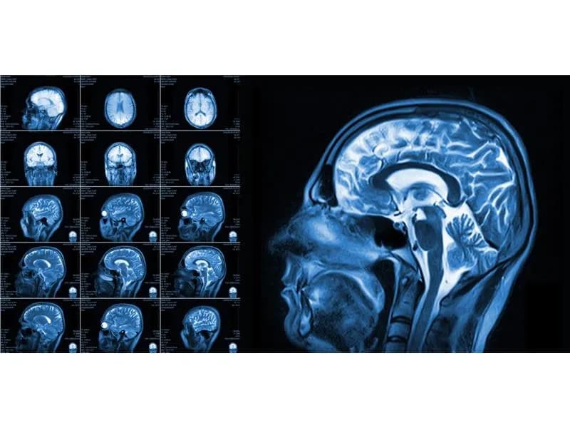 Czy lekarz rehabilitacji może wystawić skierowanie na rezonans? Sprawdź to!