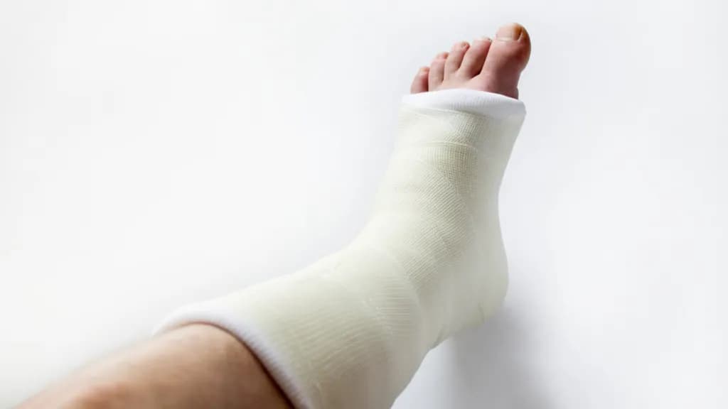 Kiedy zacząć rehabilitację po złamaniu, aby uniknąć powikłań?